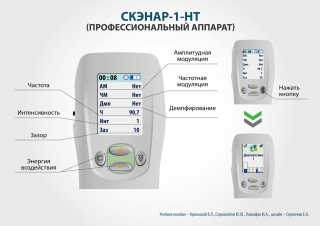 СКЭНАР-1-НТ (исполнение 01)  в Белгороде купить Медицинский интернет магазин - denaskardio.ru 